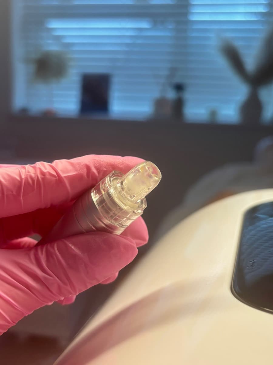 Microneedling treatment in progress at Asena Beauty, Cuffley